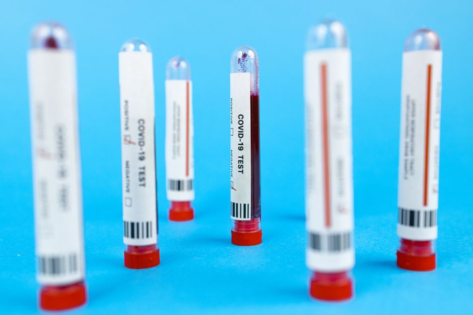 Anticorpos monoclonais (Emicizumabe): Como funciona a terapia sem fator que revolucionou o manejo da Hemofilia A.